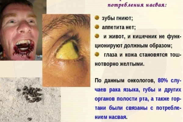 Кракен даркнет сайт ссылка